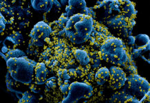 В Добрич три медицински лица има сред новорегистрираните случаи на заразени с коронавирус