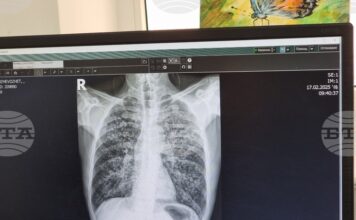 Общо 26 случая на туберкулоза са регистрирани до края на ноември в Пазарджишко
